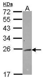 RAB2A antibody [N1C3]