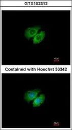 AHA-1 antibody [N1C1]