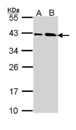 SAE1 antibody