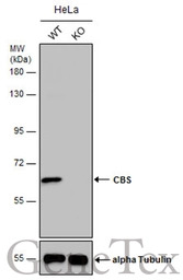 CBS antibody