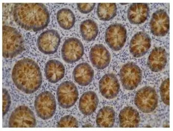 Blood Group Lewis a antibody [