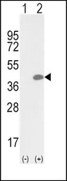OLR1 / LOX-1 antibody, Interna