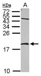 nm23-H2 antibody