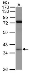 PRPS1 antibody