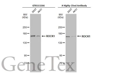 ROCK1 antibody [N1N2], N-term
