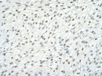 RBM9 antibody, Internal