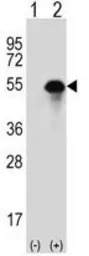 Carbonic Anhydrase 14 antibody