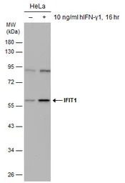 IFIT1 antibody [N1C1]