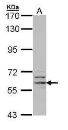 G6PD antibody [N2C1], Internal