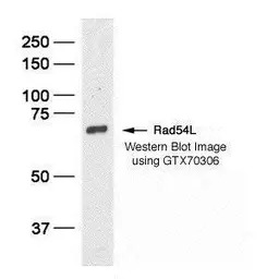 RAD54L antibody [60.1]