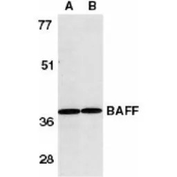 BAFF antibody