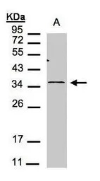 CXCR6 antibody [N2C1], Interna