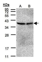 PP2A beta antibody