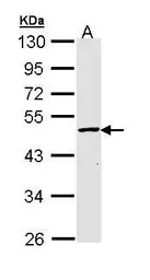 GALK2 antibody