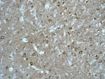 p39 antibody [EPR5074]