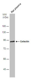 Gelsolin antibody