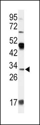 Apolipoprotein D antibody, N-t