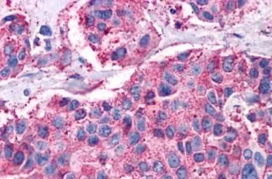 VIP receptor 1 antibody