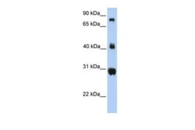 FIBCD1 antibody, C-term