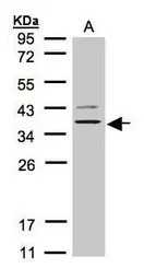 GPR86 antibody [N3C2], Interna