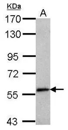 SEMA6C antibody [N1N2], N-term