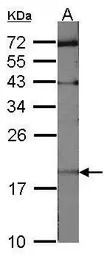 UBE2C antibody [N1C3]