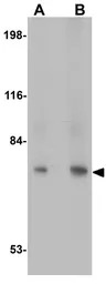 URP2 antibody