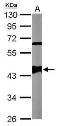 Smarcb1a antibody