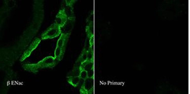 ENaC Beta antibody