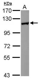 HIP1R antibody [N1N2], N-term
