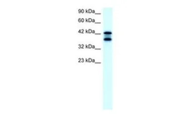ACAT2 antibody, Internal