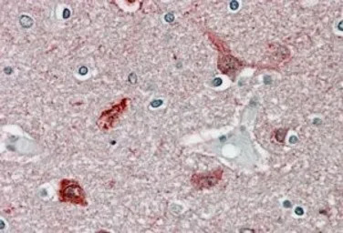 CaMKII alpha antibody, Interna