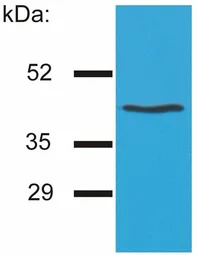 HLA-G antibody [MEM-G/4]