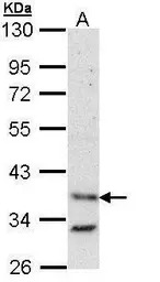 Bag1 antibody [N2C3]
