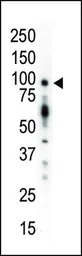 PKC mu antibody