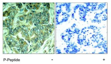 p62Dok (phospho Tyr398) antibo