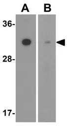 SLC39A2 antibody