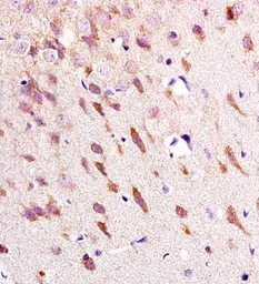 Neurokinin 2 Receptor antibody