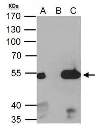 ERR alpha antibody [N1], N-ter