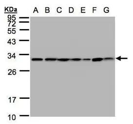 14-3-3 theta antibody