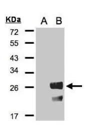 RGS19 antibody [C2C3], C-term