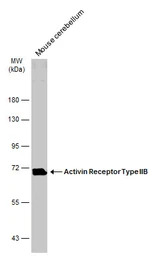 Activin Receptor Type IIB anti