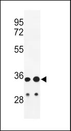 IGH antibody, C-term