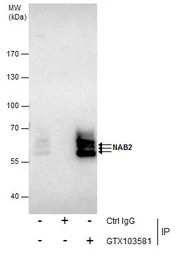 NAB2 antibody