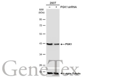 PGK1 antibody