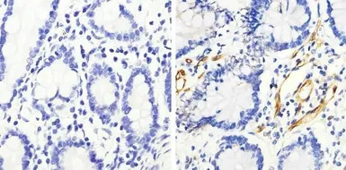 HSP27 (phospho Ser82) antibody