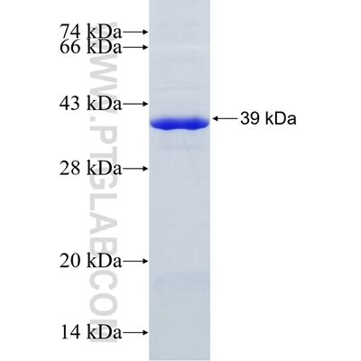HNRNPA2B1 融合蛋白