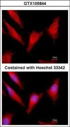 Protein C antibody