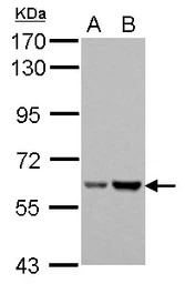 Asparagine synthetase antibody