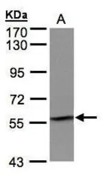 IMPDH2 antibody [N2C1], Intern